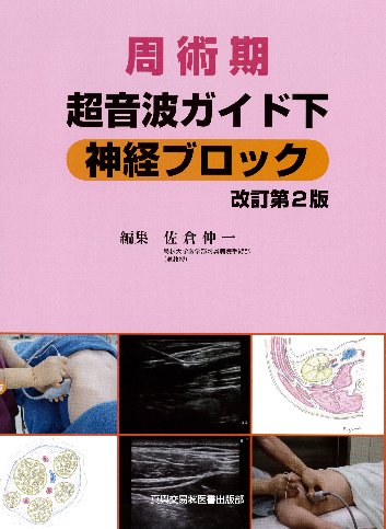 周術期超音波ガイド下神経ブロック